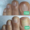 ™VeraGlow – פתרון אסתטי לציפורניים נקיות ובריאות